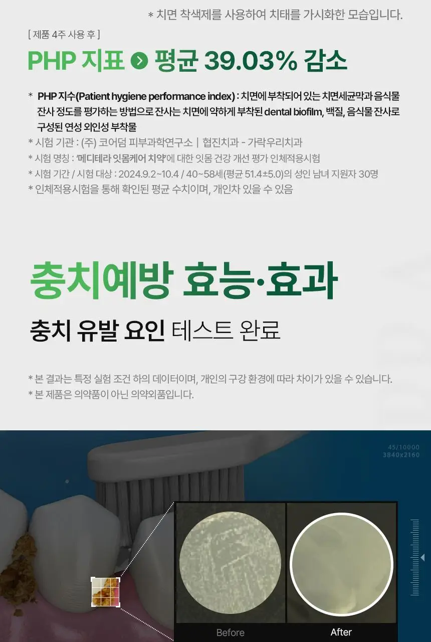 [특허성분 함유] 프로벨 메디테라 잇몸치약 (인체적용시험완료) 120g (1입/3입) 상세페이지 14